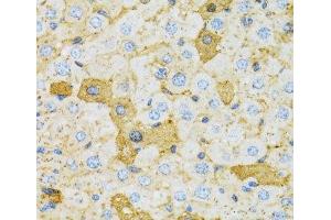Immunohistochemistry of paraffin-embedded Rat liver using OXA1L Polyclonal Antibody at dilution of 1:100 (40x lens). (OXA1L antibody)