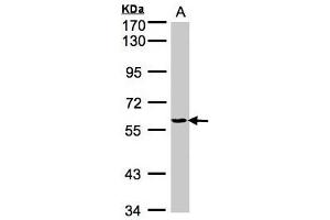 Western Blotting (WB) image for anti-Tyrosyl-tRNA Synthetase (Yars) (AA 357-520) antibody (ABIN467437) (YARS antibody  (AA 357-520))
