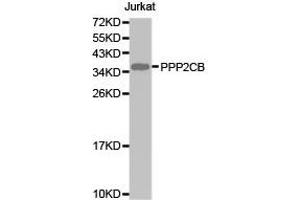 Western Blotting (WB) image for anti-Protein Phosphatase 2, Catalytic Subunit, beta Isozyme (PPP2CB) antibody (ABIN1874224) (PPP2CB antibody)