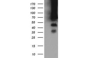 Image no. 8 for anti-tRNA Methyltransferase 2 Homolog A (TRMT2A) antibody (ABIN1501515) (TRMT2A antibody)