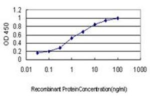 Detection limit for recombinant GST tagged SURB7 is approximately 0. (MED21 antibody  (AA 1-144))