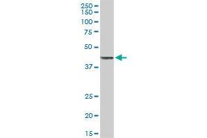 TNFRSF10B MaxPab rabbit polyclonal antibody. (TNFRSF10B antibody  (AA 1-440))