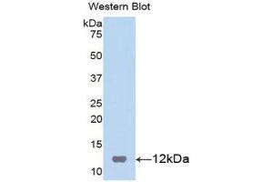 Western Blotting (WB) image for anti-S100 Calcium Binding Protein B (S100B) (AA 1-92) antibody (ABIN1860490) (S100B antibody  (AA 1-92))