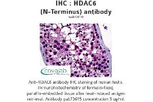 Image no. 2 for anti-Histone Deacetylase 6 (HDAC6) antibody (ABIN1735369) (HDAC6 antibody)