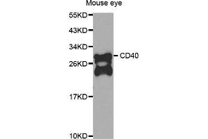 Western Blotting (WB) image for anti-CD40 (CD40) antibody (ABIN3020704)