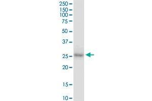 Western Blotting (WB) image for anti-Caudal Type Homeobox 1 (CDX1) (AA 126-215) antibody (ABIN560319)