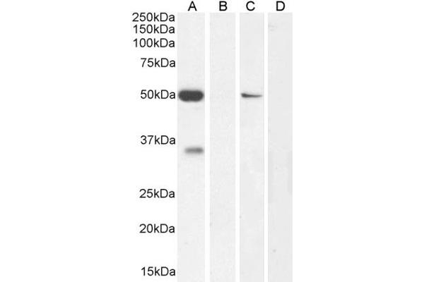 KCNN4 antibody  (Internal Region)