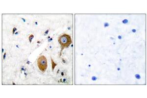 Immunohistochemical analysis of paraffin-embedded human brain tissue using GluR8 antibody (ABIN5976415).