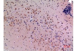 Immunohistochemistry (IHC) image for anti-Mesencephalic Astrocyte-Derived Neurotrophic Factor (MANF) (Internal Region) antibody (ABIN6287177)