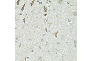 Immunohistochemistry of paraffin-embedded rat brain using SLC1A4 antibody. (SLC1A4 antibody  (AA 140-220))