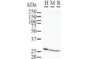 Detection of FBP3 by Western Blot. (FKBP3 antibody)