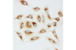 Immunohistochemistry (IHC) image for anti-Cytochrome C, Somatic (CYCS) (AA 91-105), (C-Term) antibody (ABIN3043697)