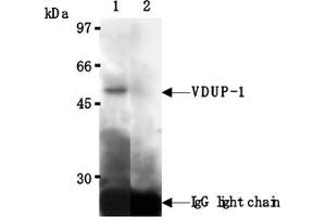 Western Blotting (WB) image for anti-Thioredoxin Interacting Protein (TXNIP) antibody (ABIN567793) (TXNIP antibody)