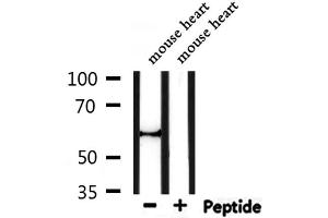 Western blot analysis of extracts from mouse heart, using Perilipin A Antibody. (PLIN1 antibody  (C-Term))