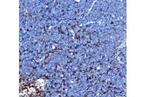 IHC analysis of TCR alpha/TRAC using anti-TCR alpha/TRAC antibody (ABIN6719654). (TRAC antibody  (AA 1-114))