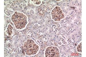 Immunohistochemistry (IHC) analysis of paraffin-embedded Human Kidney, antibody was diluted at 1:100.