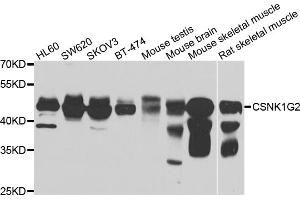 Western blot analysis of extracts of various cell lines, using CSNK1G2 antibody (ABIN4903389) at 1:1000 dilution. (Casein Kinase 1 gamma 2 antibody)