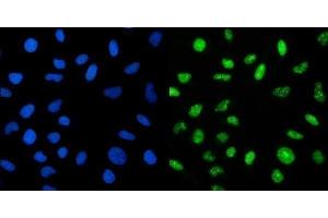 IF analysis of CRTC3 using anti-CRTC3 antibody (ABIN7599779). (CRTC3 antibody  (AA 116-619))
