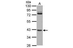 Image no. 2 for anti-SET and MYND Domain Containing 3 (SMYD3) (AA 21-416) antibody (ABIN1501007) (SMYD3 antibody  (AA 21-416))