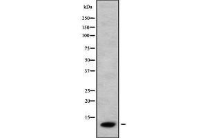Western blot analysis of CCL26 using COLO205 whole cell lysates