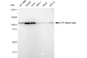 anti-ATP Citrate Lyase (ACLY) antibody