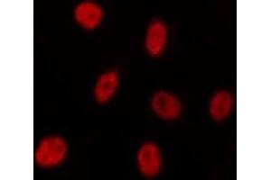 ABIN6275536 staining HepG2 by IF/ICC. (PLK5 antibody  (Internal Region))