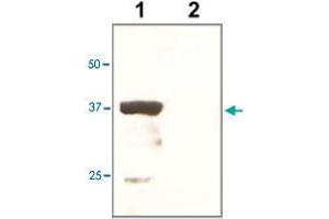 The tissue lysate derived from mouse kidney was immunoprobed by POU5F1 polyclonal antibody  at 1 : 500.