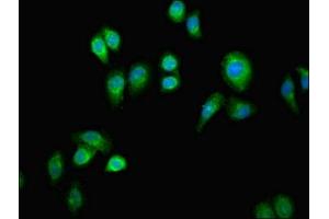 Immunofluorescent analysis of A549 cells using ABIN7154609 at dilution of 1:100 and Alexa Fluor 488-congugated AffiniPure Goat Anti-Rabbit IgG(H+L) (ERAL1 antibody  (AA 271-382))