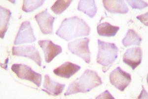 Image no. 2 for anti-Cardiac Troponin I (TNNI3) antibody (ABIN271939)