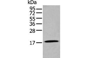 Western blot analysis of Human stomach tissue lysate using GKN2 Polyclonal Antibody at dilution of 1:250 (Gastrokine 2 antibody)