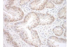 Immunohistochemistry (IHC) image for anti-RNA Binding Motif Protein 17 (RBM17) (AA 25-75) antibody (ABIN7448811)