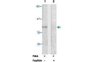 Western blot analysis of extracts from Jurkat cells, treated with PMA (125 ng/ml, 30 mins), using FCGR2B polyclonal antibody . (FCGR2B antibody  (Ser363))