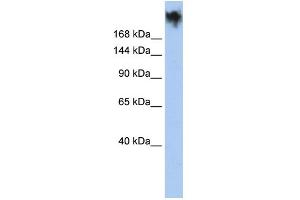 WB Suggested Anti-PKDREJ Antibody Titration:  0. (PKDREJ antibody  (Middle Region))