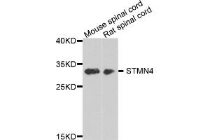 Western blot analysis of extracts of various cell lines, using STMN4 antibody (ABIN5975820) at 1/1000 dilution. (STMN4 antibody)