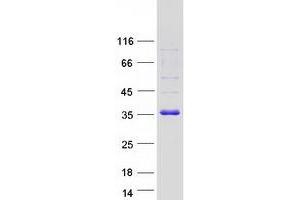 Validation with Western Blot (CBR1 Protein (Myc-DYKDDDDK Tag))