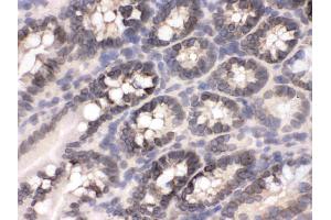 Immunohistochemistry (IHC) image for anti-Exportin 1 (XPO1) (AA 966-1071) antibody (ABIN4886771)