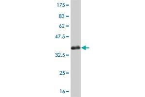 Western Blotting (WB) image for anti-serum/glucocorticoid Regulated Kinase 2 (SGK2) (AA 293-367) antibody (ABIN523485)