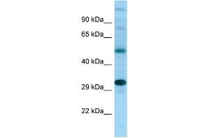 Western Blotting (WB) image for anti-NDRG Family Member 4 (NDRG4) (C-Term) antibody (ABIN2789943) (NDRG4 antibody  (C-Term))