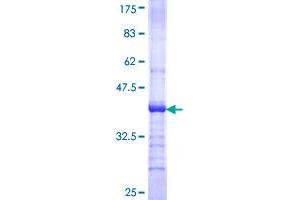 MGAT4A Protein (AA 436-535) (GST tag)