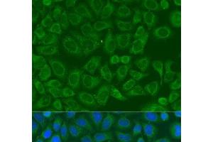 Immunofluorescence analysis of U2OS cells using ICK Polyclonal Antibody at dilution of 1:100.