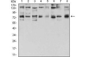 Western blot analysis using GFPT1 mouse mAb against Hela (1), HepG2 (2), HEK293 (3), BEL-7402 (4), SMMC-7721 (5), SK-MES-1 (6), C6 (7), and COS7 (8) cell lysate. (GFPT1 antibody  (AA 536-681))