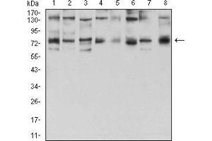 Western blot analysis using GFPT1 mouse mAb against Hela (1), HepG2 (2), HEK293 (3), BEL-7402 (4), SMMC-7721 (5), SK-MES-1 (6), C6 (7), and COS7 (8) cell lysate.