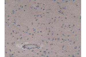 IHC-P analysis of Human Brain Tissue, with DAB staining. (ABCC8 antibody  (AA 679-929))