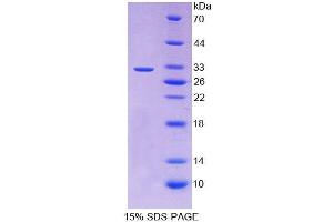 SDS-PAGE analysis of Human RARb Protein. (Retinoic Acid Receptor beta Protein)