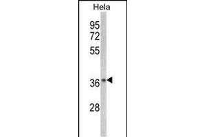 Western blot analysis of NFKBIA-S32/36 (ABIN652417 and ABIN2842077) in Hela cell line lysates (35 μg/lane). (NFKBIA antibody  (AA 12-41))