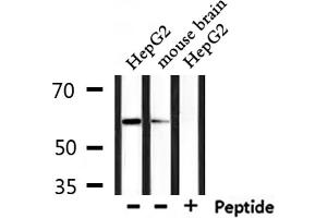 Western blot analysis of extracts from mouse brain and HepG2, using Caspase 10 Antibody.