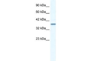 WB Suggested Anti-MTA1 Antibody Titration:  2. (MTA1 antibody  (C-Term))