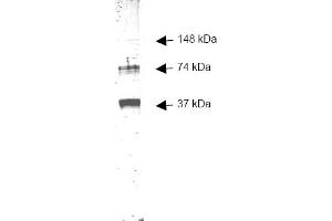 Figure 1. (ADH1 antibody)