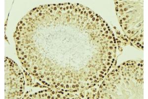ABIN6276851 at 1/100 staining Mouse testis tissue by IHC-P. (LIG4 antibody  (C-Term))