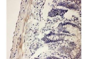 IHC-P testing of rat intestine tissue (COX1 antibody  (AA 318-599))